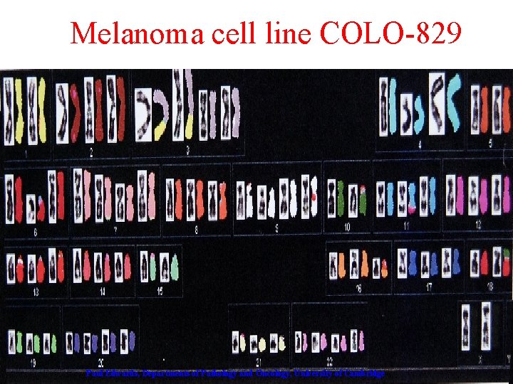 Melanoma cell line COLO-829 Paul Edwards, Departments of Pathology and Oncology, University of Cambridge