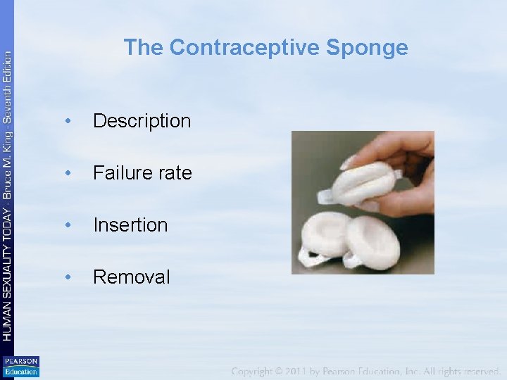 The Contraceptive Sponge • Description • Failure rate • Insertion • Removal 