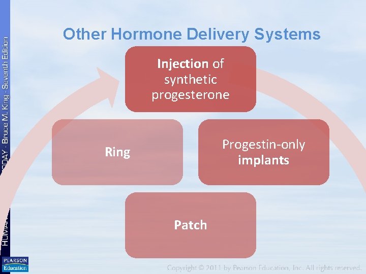 Other Hormone Delivery Systems Injection of synthetic progesterone Progestin-only implants Ring Patch 