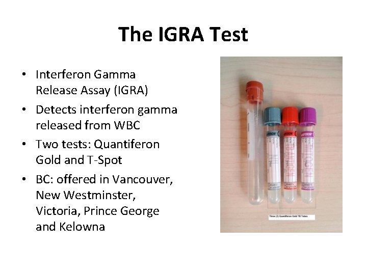 The IGRA Test • Interferon Gamma Release Assay (IGRA) • Detects interferon gamma released