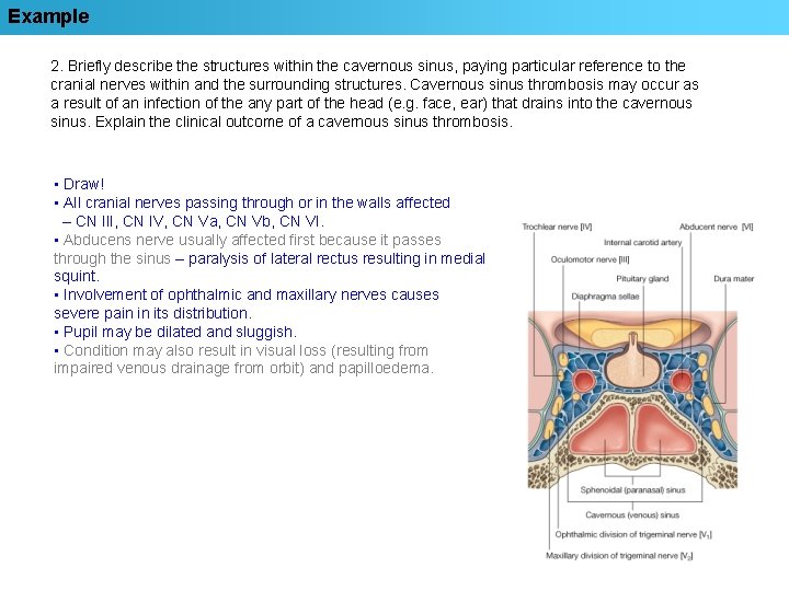 Example 2. Briefly describe the structures within the cavernous sinus, paying particular reference to