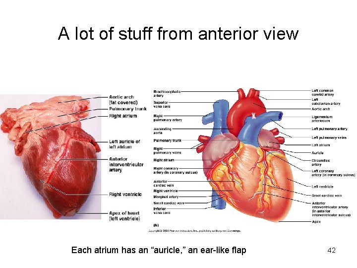 A lot of stuff from anterior view Each atrium has an “auricle, ” an A lot of stuff from anterior view Each atrium has an “auricle, ” an