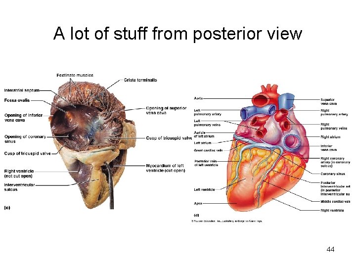 A lot of stuff from posterior view 44  A lot of stuff from posterior view 44