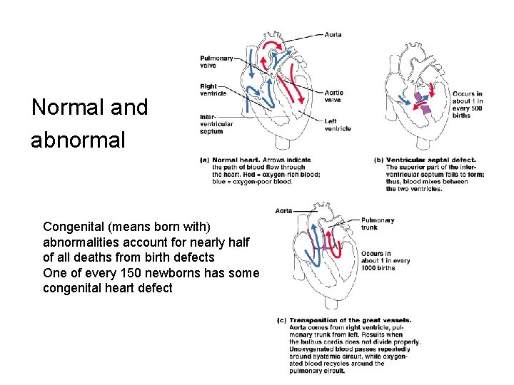 Normal and abnormal Congenital (means born with) abnormalities account for nearly half of all Normal and abnormal Congenital (means born with) abnormalities account for nearly half of all