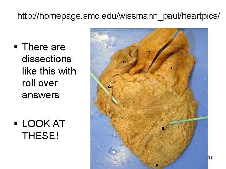 http: //homepage. smc. edu/wissmann_paul/heartpics/ § There are dissections like this with roll over answers http: //homepage. smc. edu/wissmann_paul/heartpics/ § There are dissections like this with roll over answers