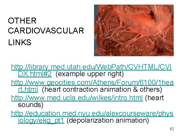 OTHER CARDIOVASCULAR LINKS http: //library. med. utah. edu/Web. Path/CVHTML/CVI DX. html#2 (example upper right) OTHER CARDIOVASCULAR LINKS http: //library. med. utah. edu/Web. Path/CVHTML/CVI DX. html#2 (example upper right)