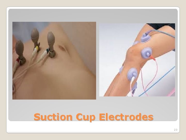 Suction Cup Electrodes 23 