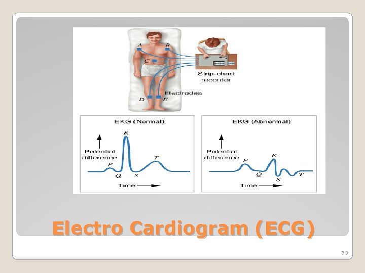 Electro Cardiogram (ECG) 73 