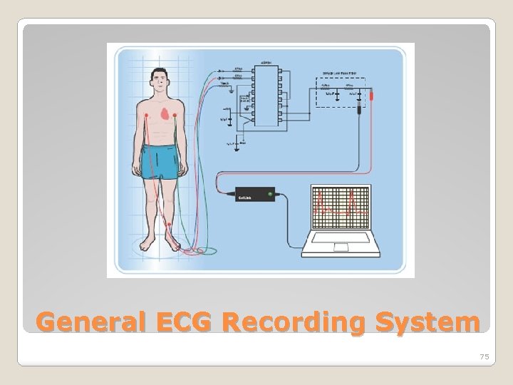 General ECG Recording System 75 