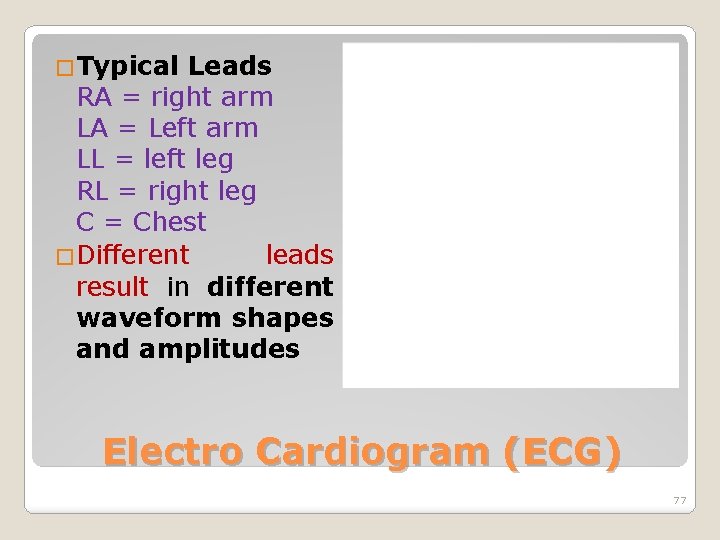 �Typical Leads RA = right arm LA = Left arm LL = left leg