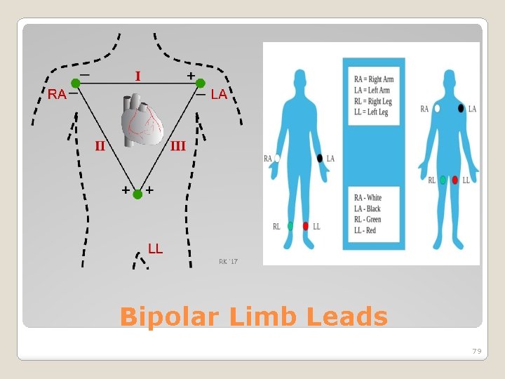 Bipolar Limb Leads 79 