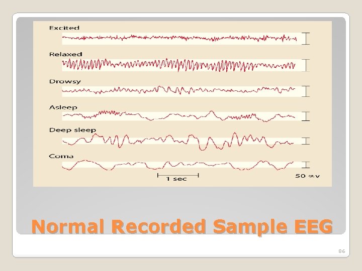 Normal Recorded Sample EEG 86 