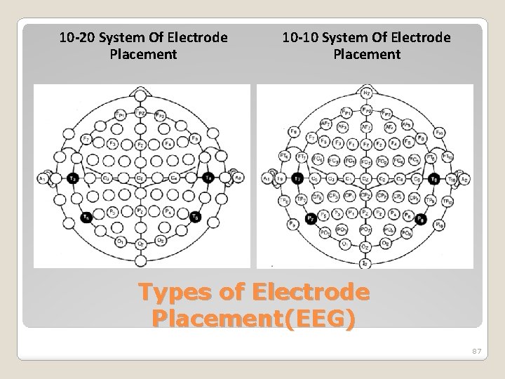 10 -20 System Of Electrode Placement 10 -10 System Of Electrode Placement Types of