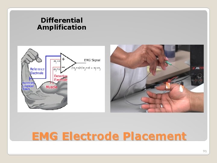 Differential Amplification EMG Electrode Placement 91 