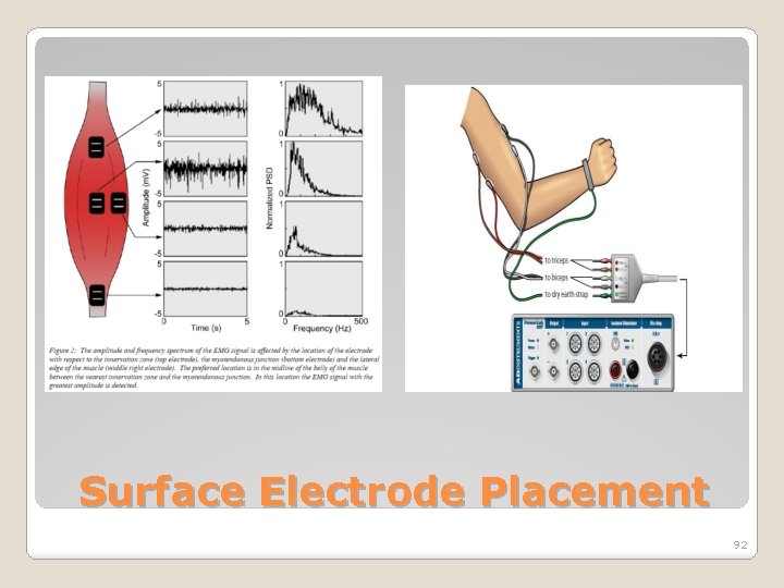 Surface Electrode Placement 92 