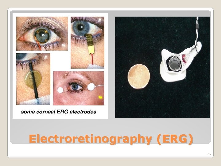 Electroretinography (ERG) 96 