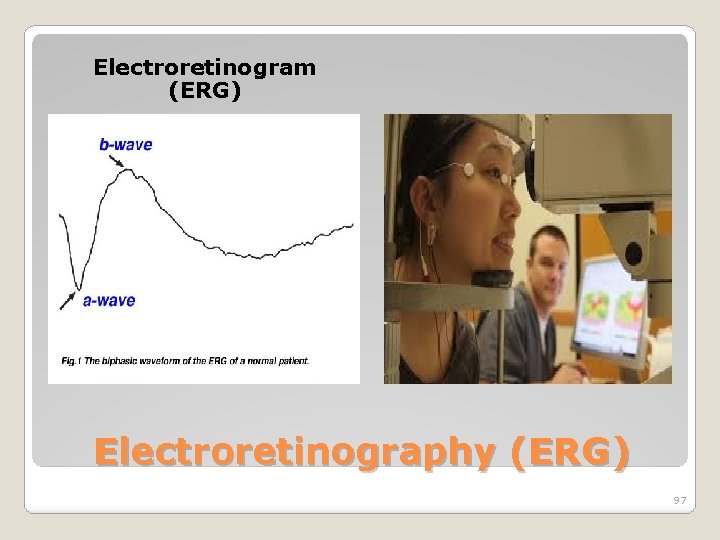 Electroretinogram (ERG) Electroretinography (ERG) 97 