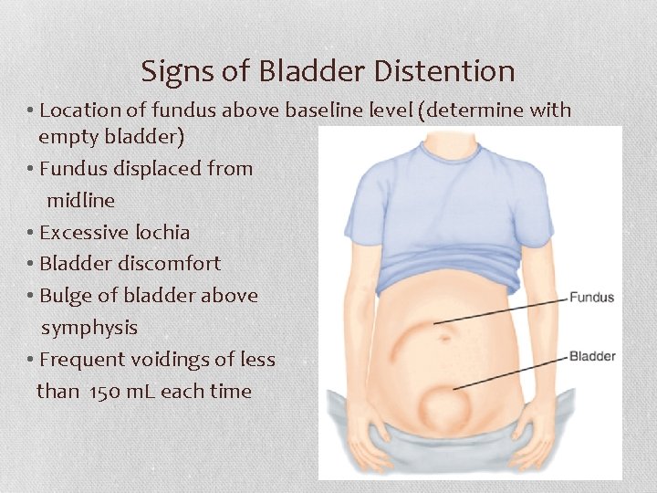 Signs of Bladder Distention • Location of fundus above baseline level (determine with empty