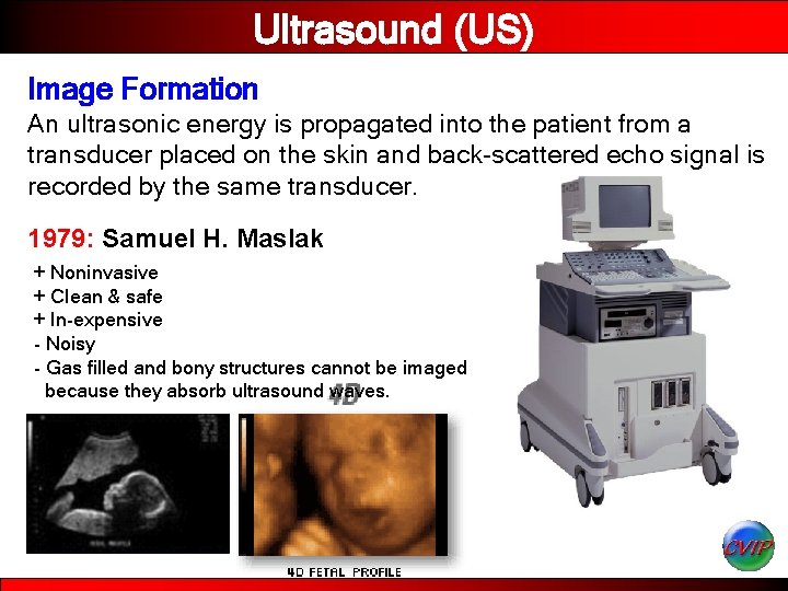 Ultrasound (US) Image Formation An ultrasonic energy is propagated into the patient from a