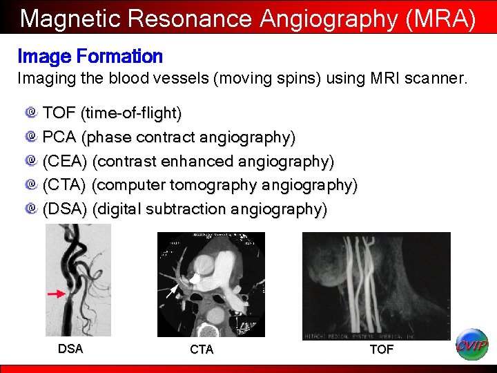 Magnetic Resonance Angiography (MRA) Image Formation Imaging the blood vessels (moving spins) using MRI