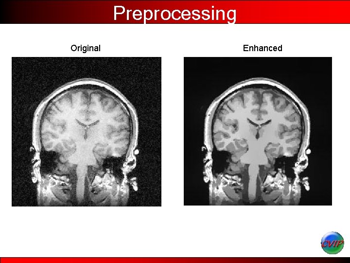 Preprocessing Original Enhanced 