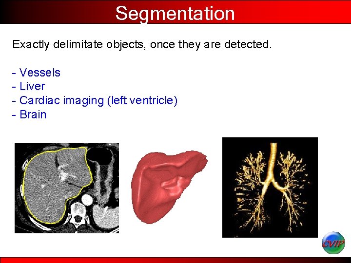 Segmentation Exactly delimitate objects, once they are detected. - Vessels - Liver - Cardiac