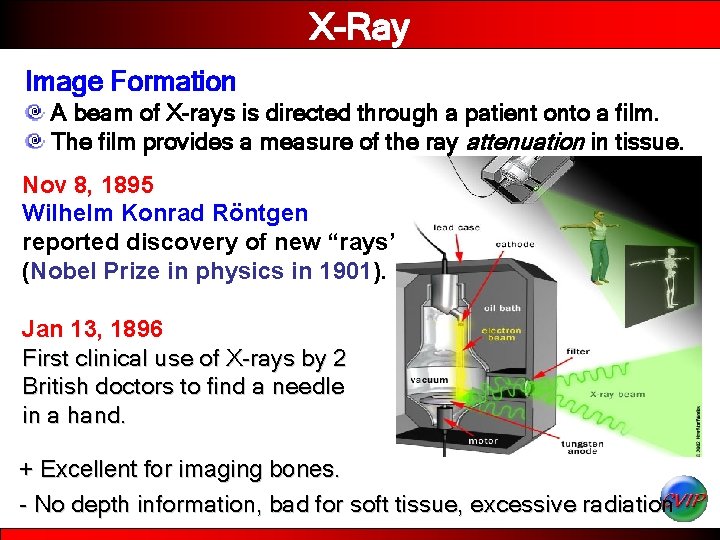 X-Ray Image Formation A beam of X-rays is directed through a patient onto a