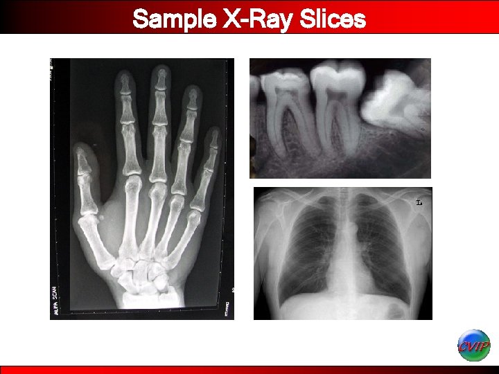 Sample X-Ray Slices 