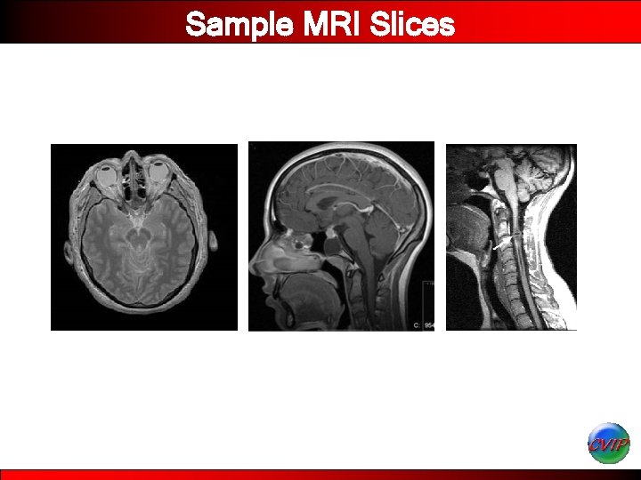 Sample MRI Slices 