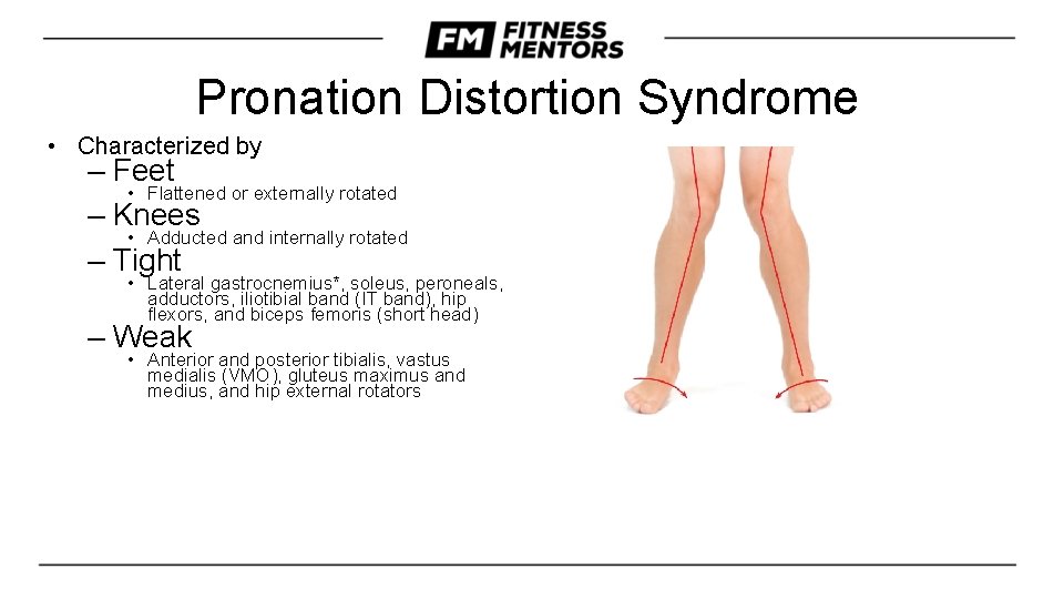 Pronation Distortion Syndrome • Characterized by – Feet • Flattened or externally rotated –