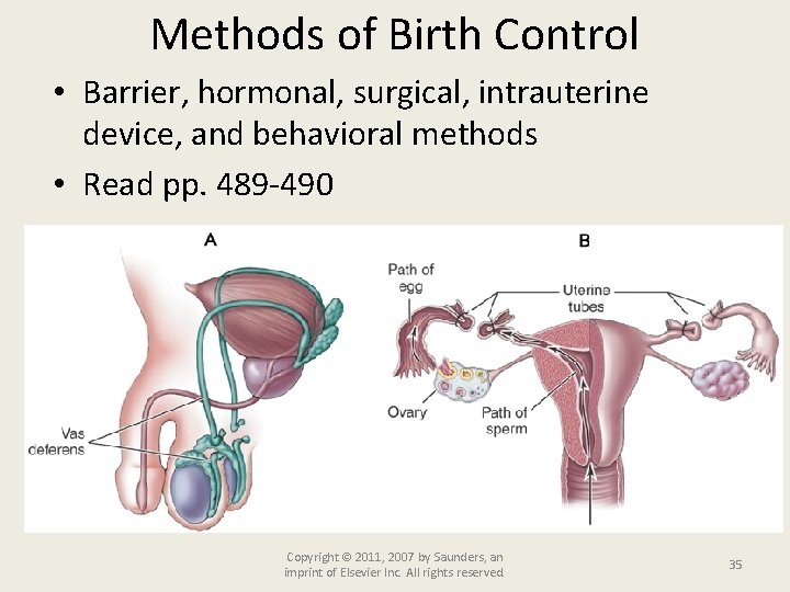 Methods of Birth Control • Barrier, hormonal, surgical, intrauterine device, and behavioral methods •