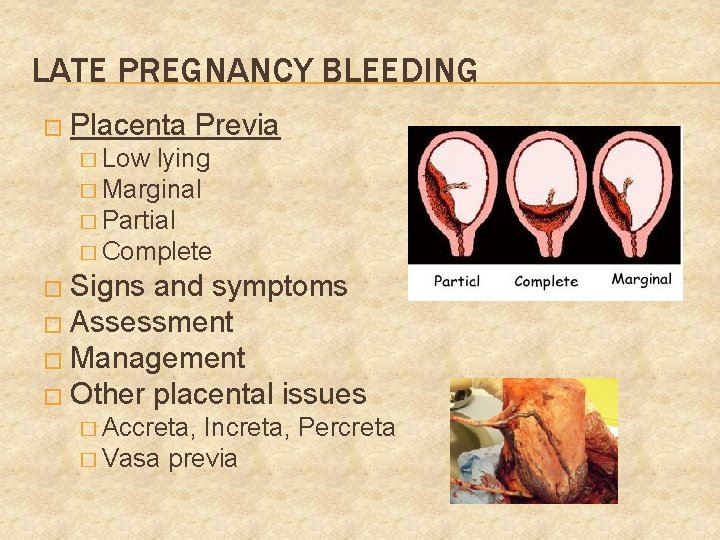 LATE PREGNANCY BLEEDING � Placenta Previa � Low lying � Marginal � Partial �