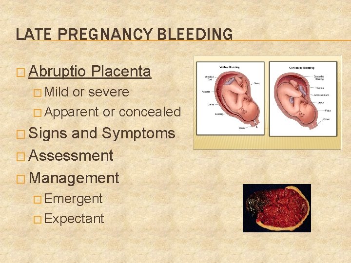 LATE PREGNANCY BLEEDING � Abruptio Placenta � Mild or severe � Apparent or concealed