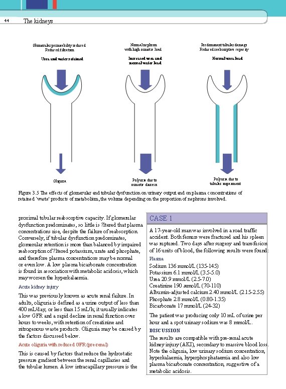 44 The kidneys Glomerular permeability reduced Reduced filtration Urea and water retained Oliguria Normal