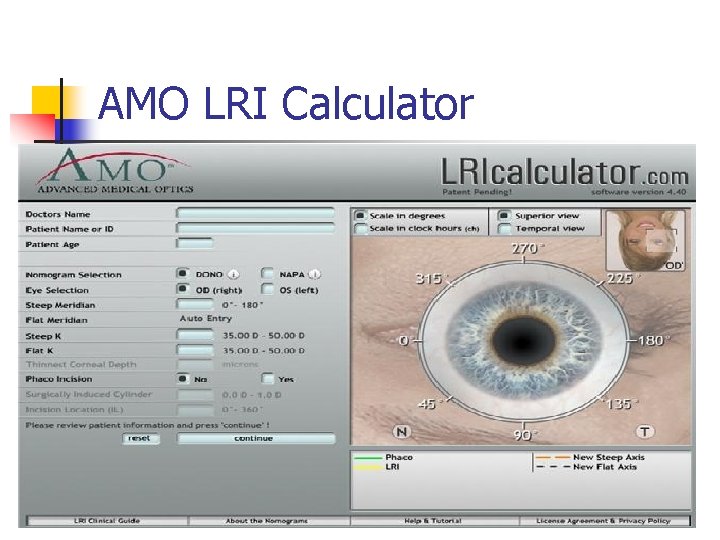AMO LRI Calculator 