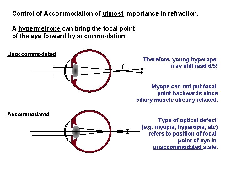 Control of Accommodation of utmost importance in refraction. A hypermetrope can bring the focal