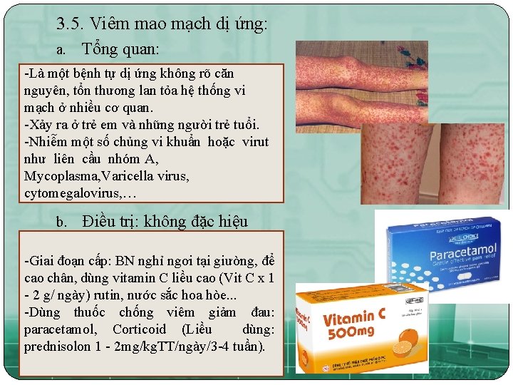 3. 5. Viêm mao mạch dị ứng: a. Tổng quan: -Là một bệnh tự