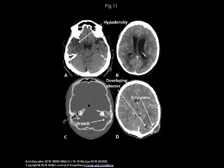 Fig 11 BJA Education 2018 18300 -309 DOI: (10. 1016/j. bjae. 2018. 06. 005)