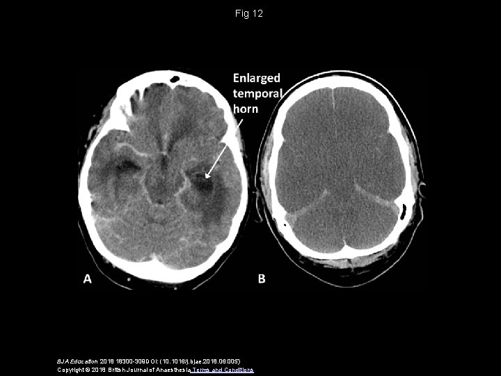 Fig 12 BJA Education 2018 18300 -309 DOI: (10. 1016/j. bjae. 2018. 06. 005)