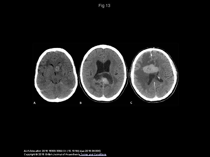 Fig 13 BJA Education 2018 18300 -309 DOI: (10. 1016/j. bjae. 2018. 06. 005)