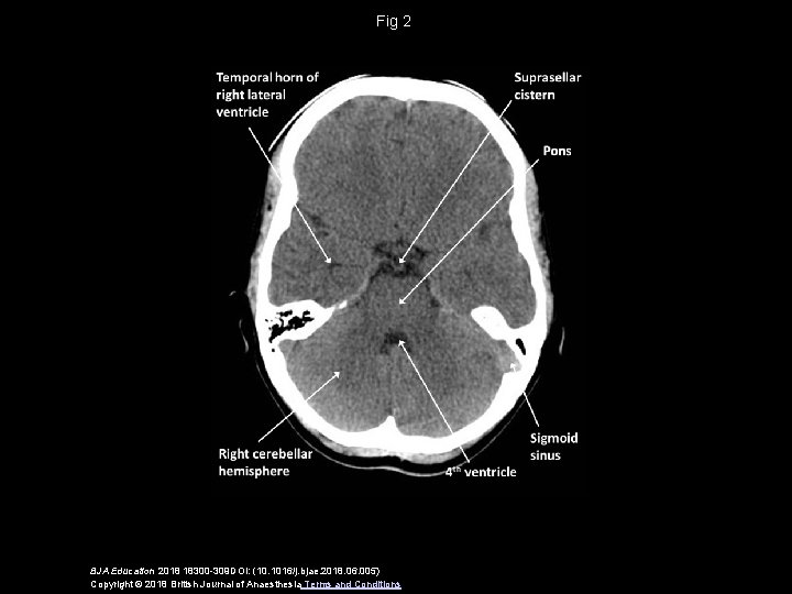 Fig 2 BJA Education 2018 18300 -309 DOI: (10. 1016/j. bjae. 2018. 06. 005)