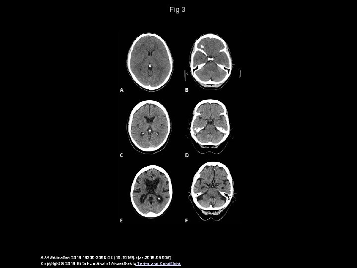 Fig 3 BJA Education 2018 18300 -309 DOI: (10. 1016/j. bjae. 2018. 06. 005)