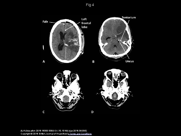 Fig 4 BJA Education 2018 18300 -309 DOI: (10. 1016/j. bjae. 2018. 06. 005)