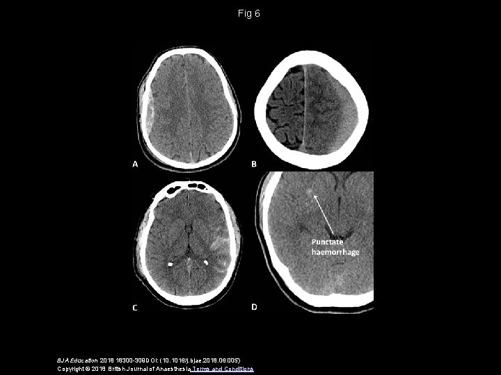 Fig 6 BJA Education 2018 18300 -309 DOI: (10. 1016/j. bjae. 2018. 06. 005)