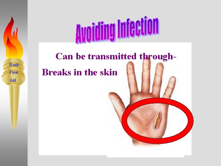 Can be transmitted through. Basic First Aid Breaks in the skin 