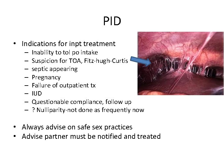 PID • Indications for inpt treatment – – – – Inability to tol po
