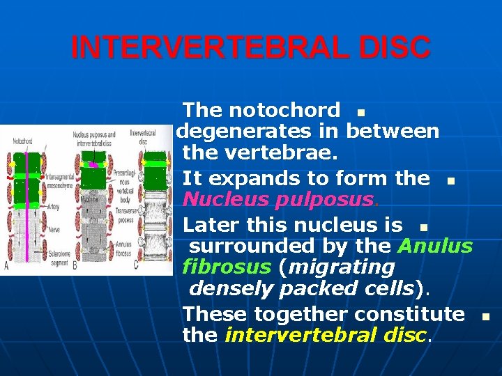 INTERVERTEBRAL DISC The notochord n degenerates in between the vertebrae. It expands to form