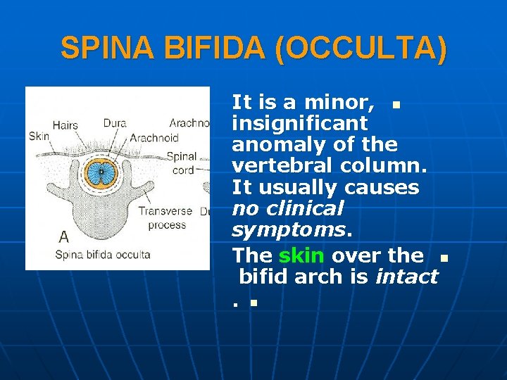 SPINA BIFIDA (OCCULTA) It is a minor, n insignificant anomaly of the vertebral column.