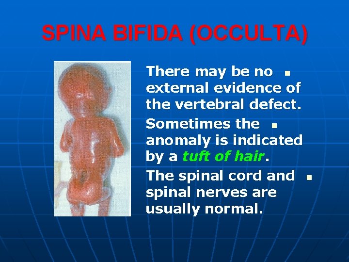 SPINA BIFIDA (OCCULTA) There may be no n external evidence of the vertebral defect.
