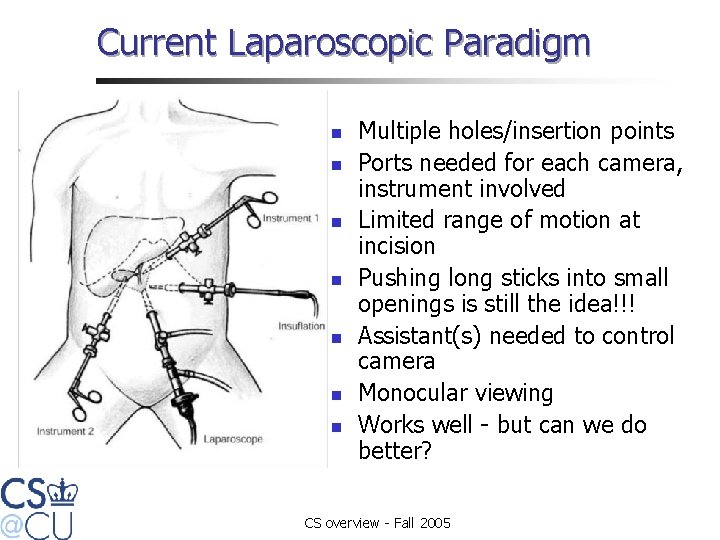 Current Laparoscopic Paradigm n n n n Multiple holes/insertion points Ports needed for each